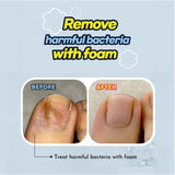 Easy Foo Keeper - Foot and Nail Fungus Care Serum