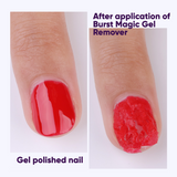 BURST MAGIC GEL REMOVER