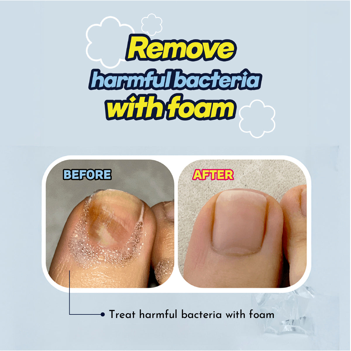 Easy Foo Keeper - Foot and Nail Fungus Care Serum