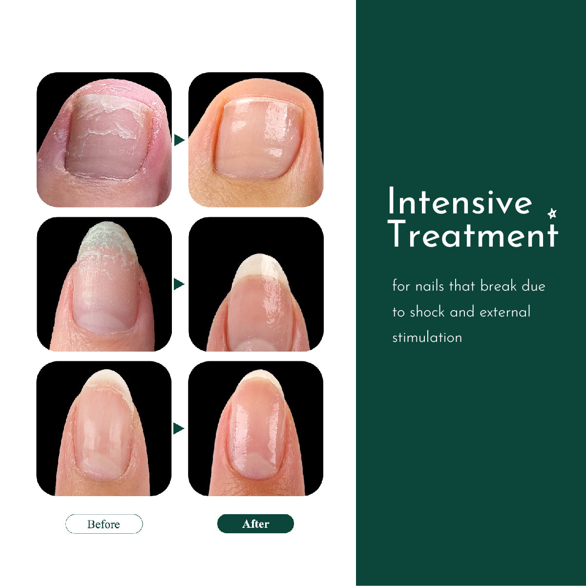 WithShyan Korea Root intensive nail protector 6