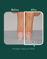 WithShyan Korea Root intensive nail protector 9