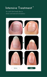 WithShyan Korea Root intensive nail protector recommended for
